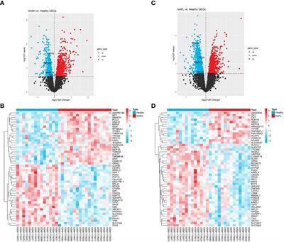 Identification of ribosomal protein family as immune-cell-related biomarkers of NAFLD by bioinformatics and experimental analyses